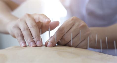 Practices with services for Acupuncture near Doubleview, WA 6018.